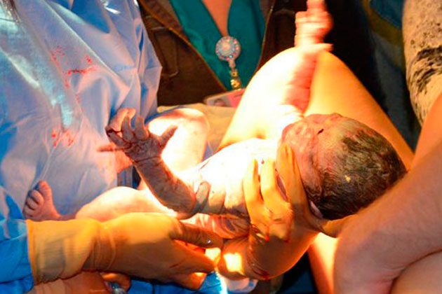 ¡Sorprendente! Bebé comenzó a caminar minutos después de nacer