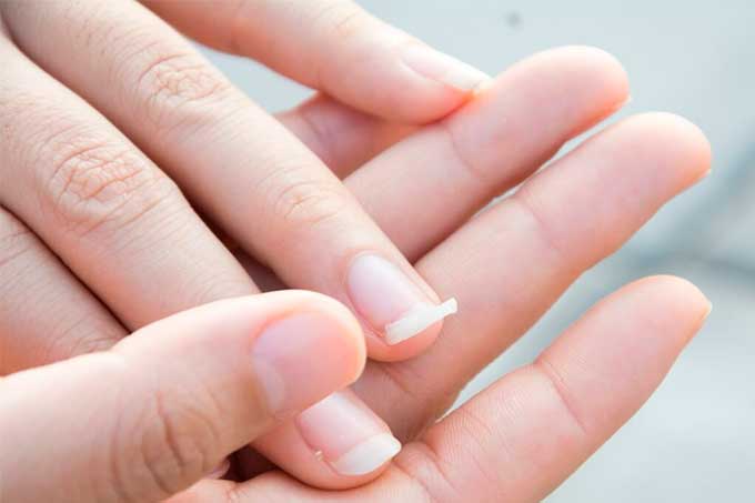 ¿Tienes uñas quebradizas? Atenta a estos tips para fortalecerlas