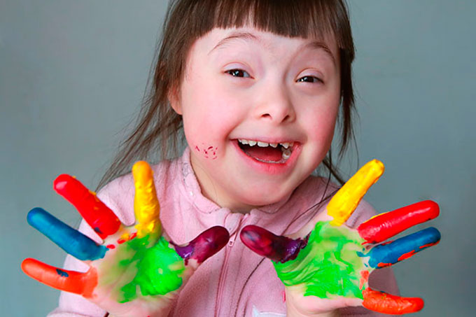 Cada 21 de marzo se celebra el Día Mundial del Síndrome de Down