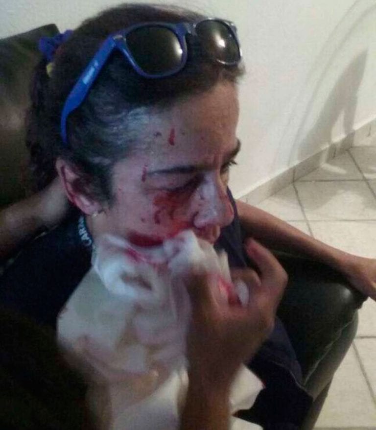 ZODI desmintió que periodista Carolina González fue herida por bomba lacrimógena