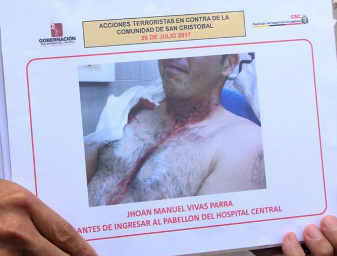 Herido motociclista en Táchira por guaya colocada en protesta