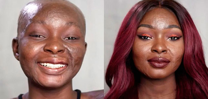 ¡Sorprendente! Víctima de quemaduras crea tutoriales de maquillaje en YouTube