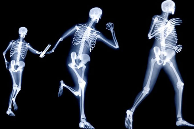 ¡Ama tus huesos! Hoy es el Día Mundial contra la Osteoporosis