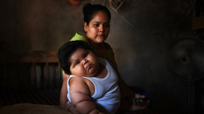 ¡30 kilos! Estudian caso de bebé de 10 meses con sobrepeso en México