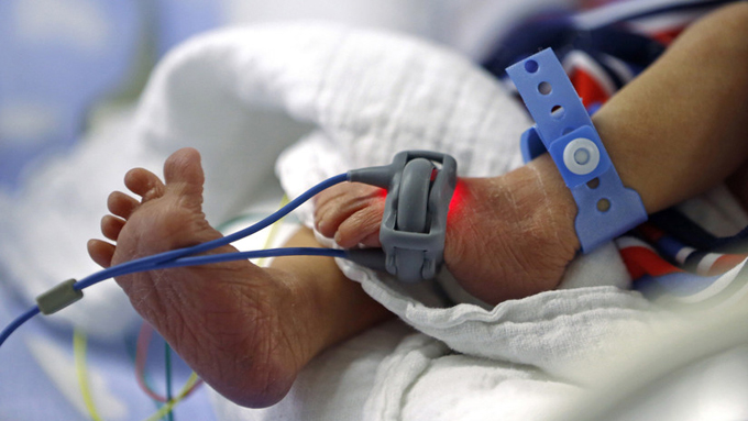 Sobrevivió una bebé que nació con el corazón fuera de su cuerpo