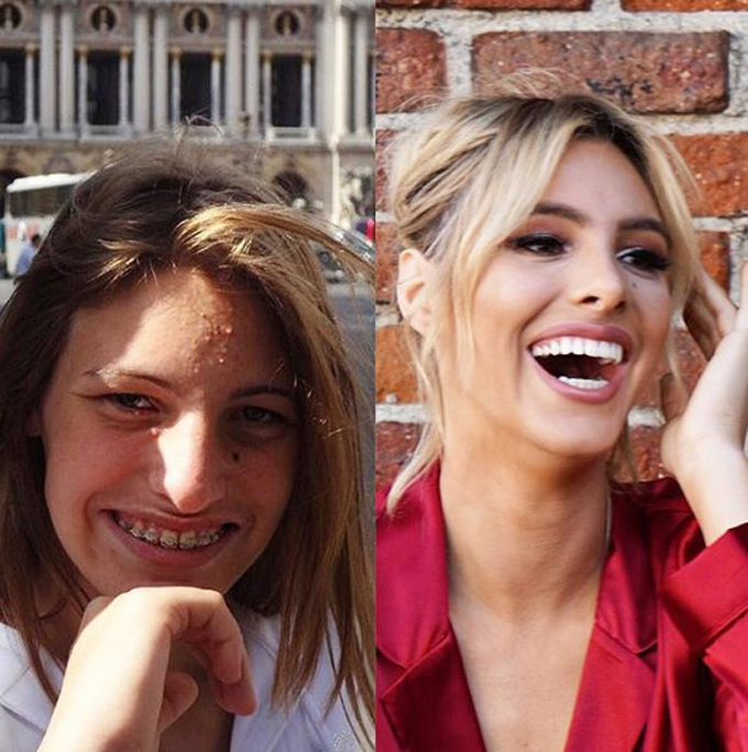 ¡Increíble! El antes y después de la venezolana Lele Pons (+fotos)