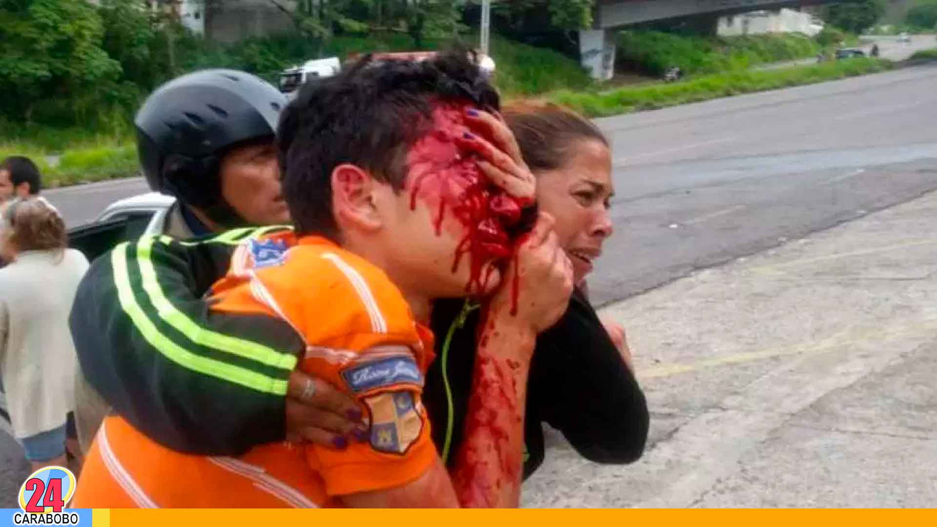 Noticias 24 Carabobo - Dejan ciego a líceista en Táchira