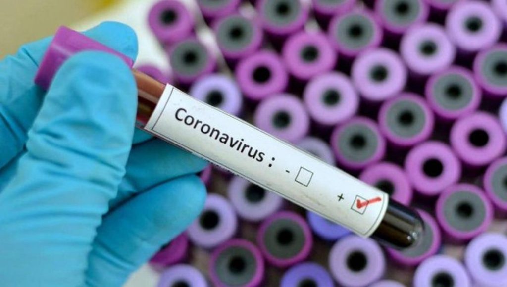 Casos de Coronavirus en EEUU, Francia y Nepal - Noticias 24 Carabobo