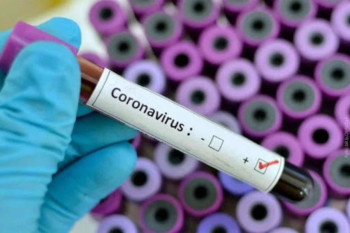 Nuevos casos de coronavirus en Venezuela