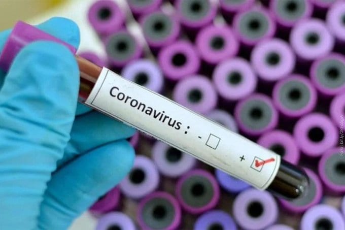 Cinco personas en terapia intensiva por coronavirus en Venezuela