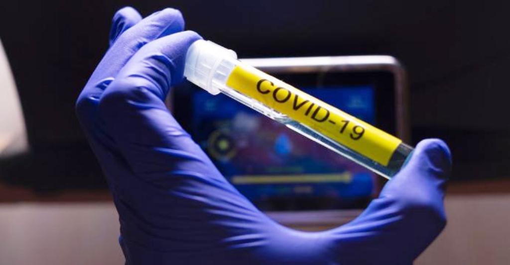 Vacuna de Oxford es segura - noticias24 Carabobo