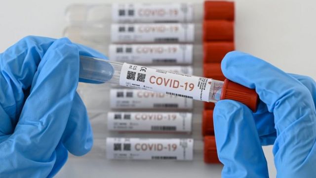 Covid-19 en el mundo: casi 60 millones de personas se han contagiado