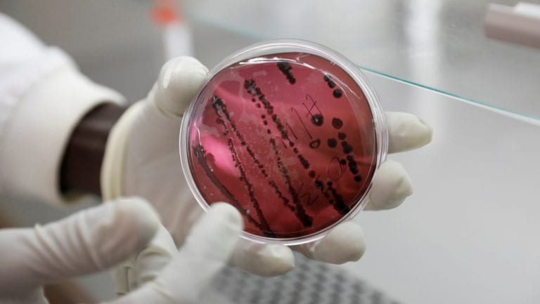 Virus similar al Ébola es capaz de transmitirse de persona a persona
