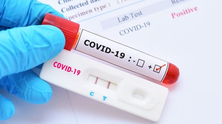 271 casos de COVID-19 en el municipio San Diego