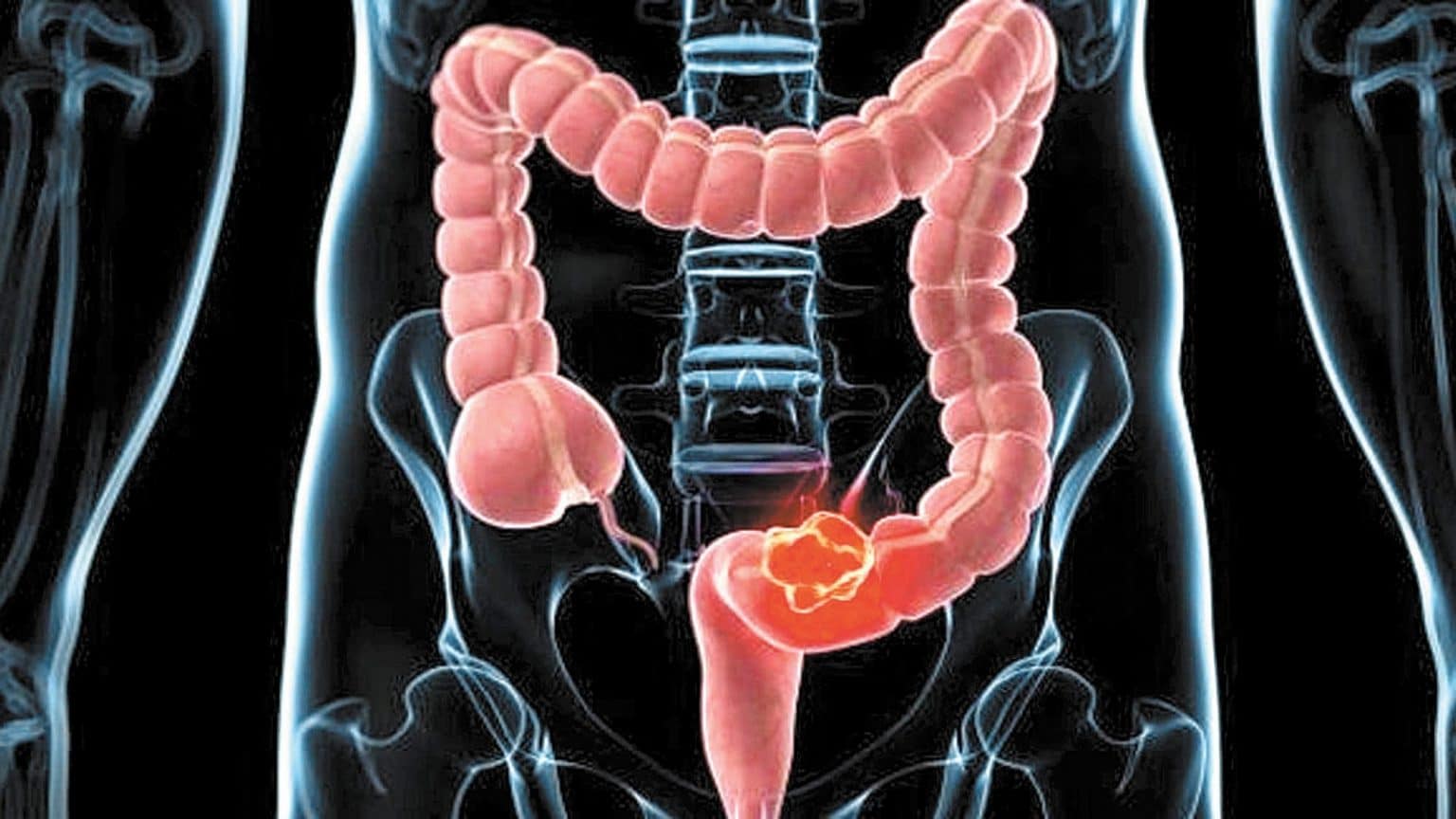 Colon conoce como cuidar este importante órgano