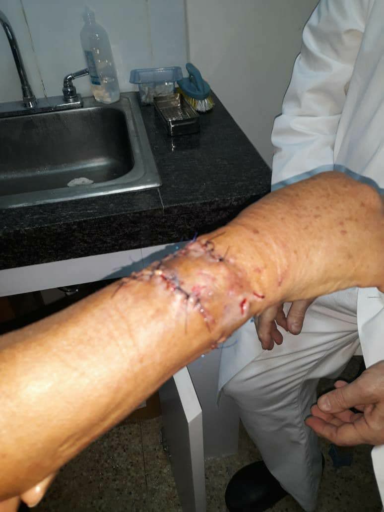 Pastor belga atacó a una abuela en Caricuao - Pastor belga atacó a una abuela en Caricuao