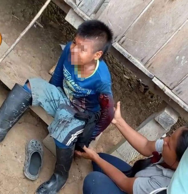 Herido niño indígena por la Policía antinarcóticos de Colombia