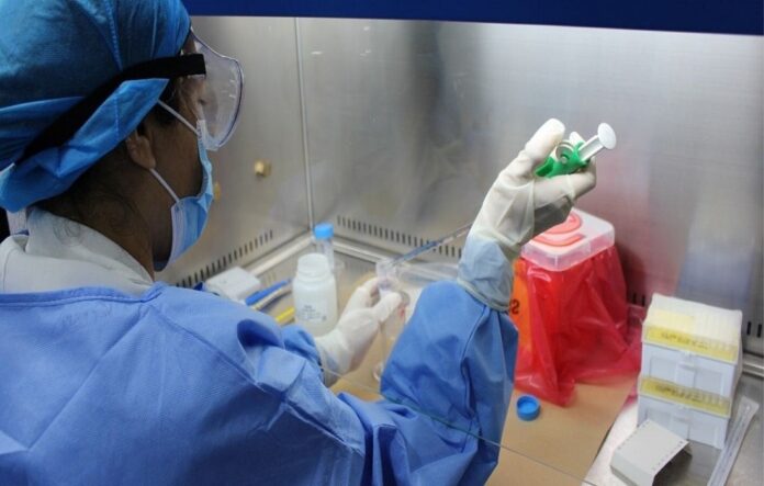OPS: laboratorios de Venezuela están sobrecargados para las pruebas de Covid-19