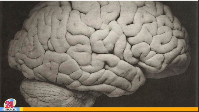 El cerebro y el COVID 19 - El cerebro y el COVID 19