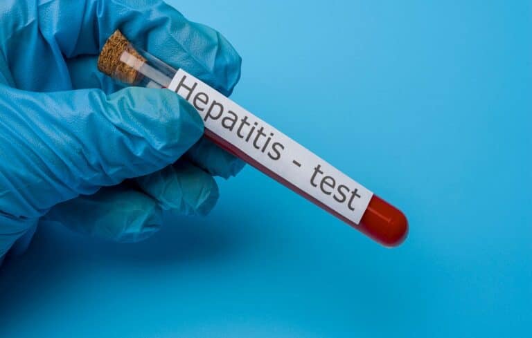 Estados Unidos informan aparición de atípico brote de hepatitis