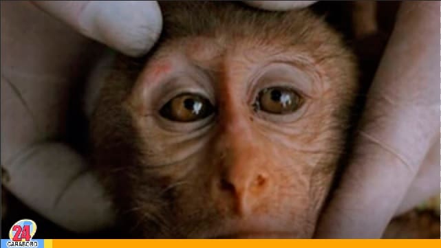 ¡No hay alarma! Academia de Medicina de Venezuela habló de la viruela de mono