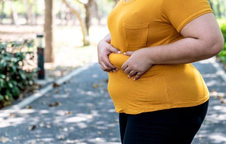 Al menos 30% de la poblacioen sufre de obesidad en Venezuela