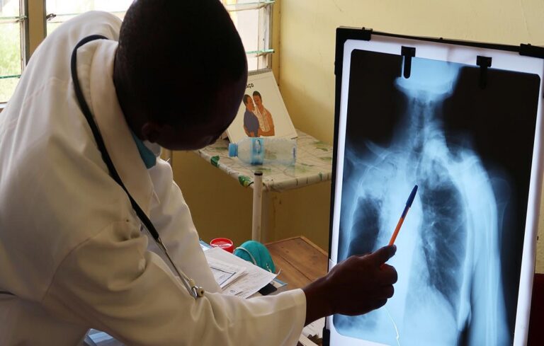 Se reportaron 11 mil casos de tuberculosis en Venezuela