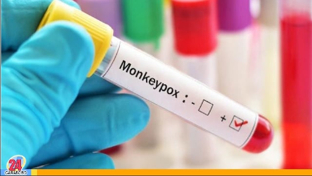 Detectados dos casos de viruela del mono en Venezuela
