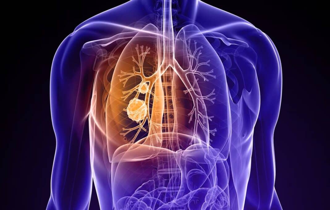 proteína reproducción cáncer de pulmón