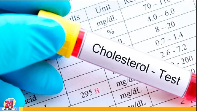 Síntomas del colesterol alto - Síntomas del colesterol alto