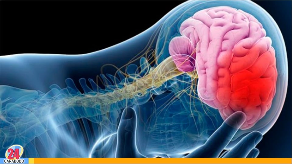 Accidente cerebrovascular