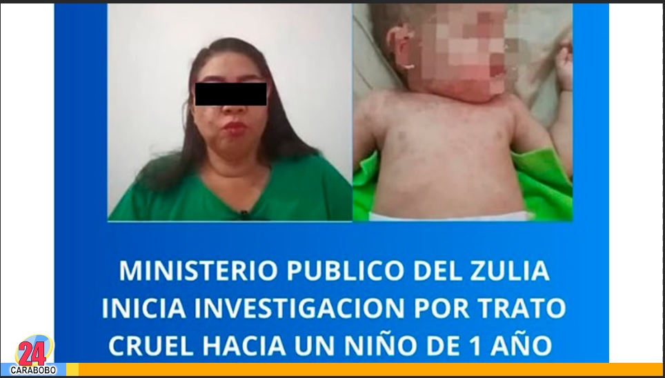 Trato cruel a un niño en el Zulia