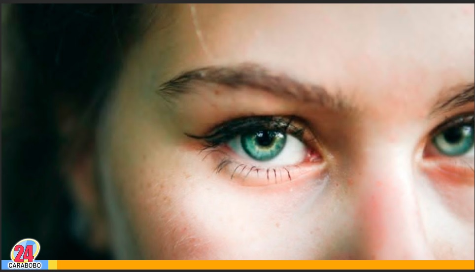 Eliminar las ojeras de una manera natural