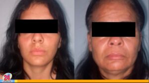 Atacaron a una mujer con un bisturí