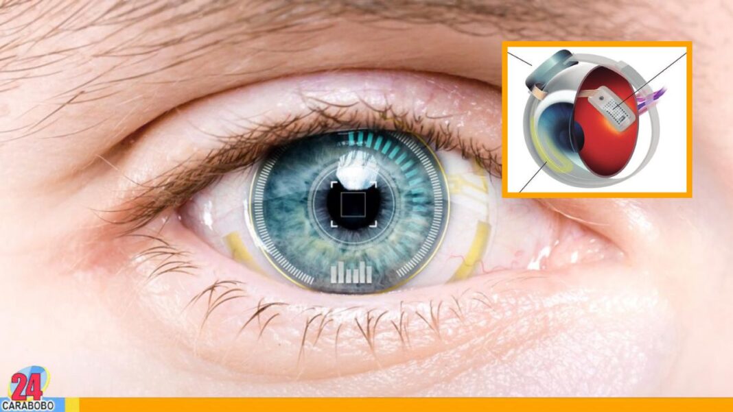 Cientificos desarrollan implante de retina para la degeneración visual