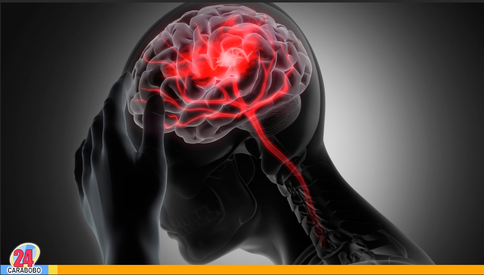 Síntomas antes de un accidente cerebrovascular (ACV)