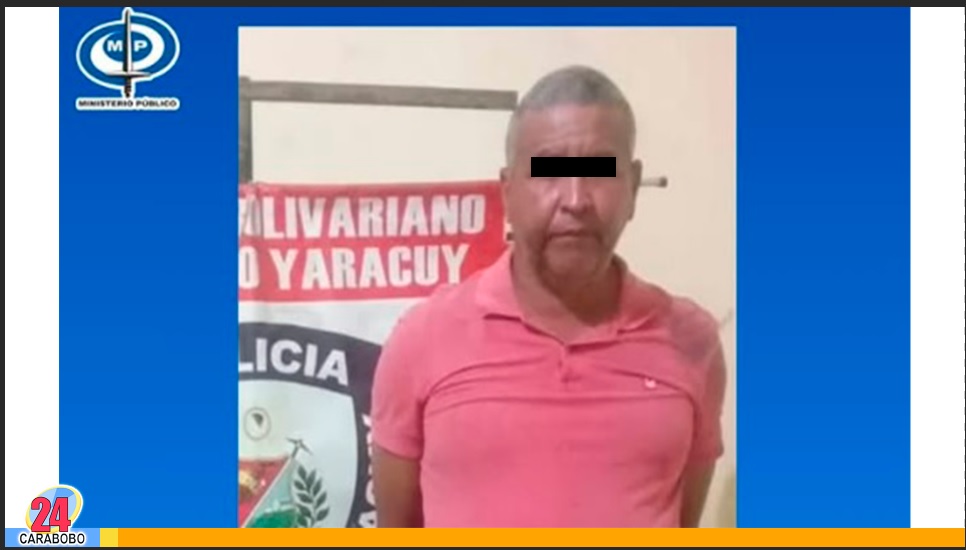 Hombre que quemó a la joven enfermera será imputado por el Ministerio Público