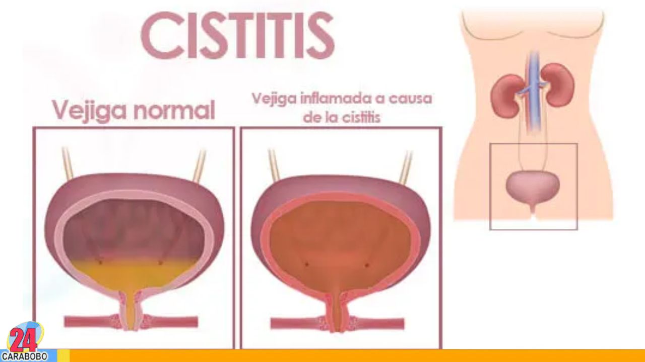 Conoce cinco que podrían confundirse con 3