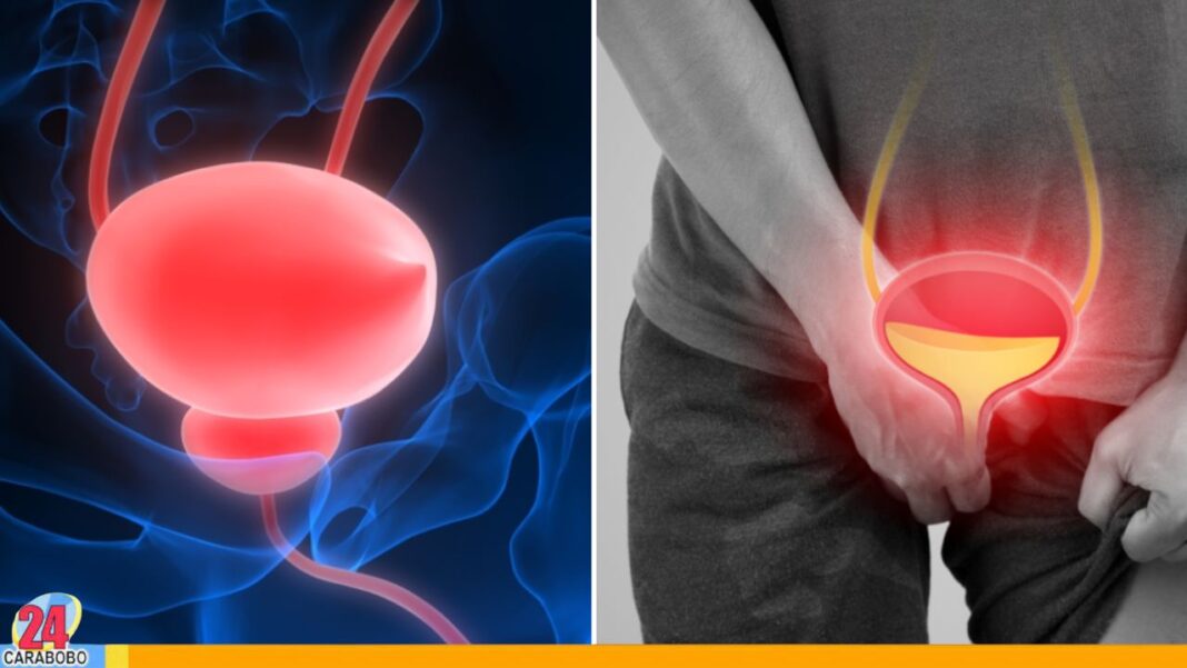 Conoce cinco afecciones que podrían confundirse con cáncer de próstata