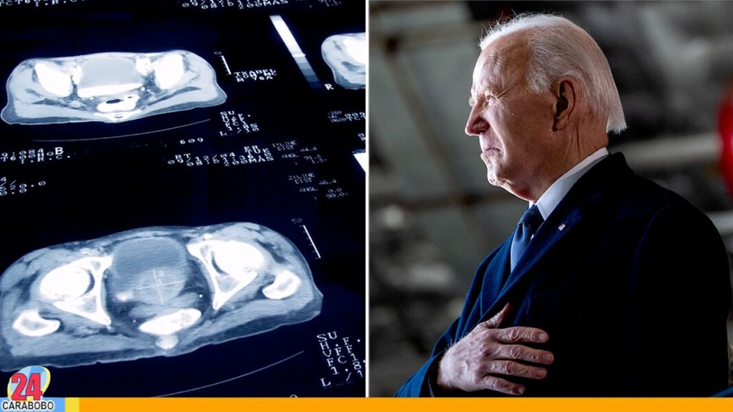 Expresidente de Estados Unidos Joe Biden finaliza su radioterapia contra el cáncer