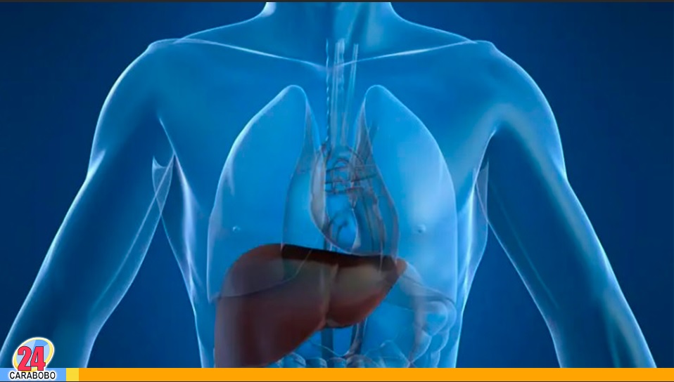 cirrosis hepática