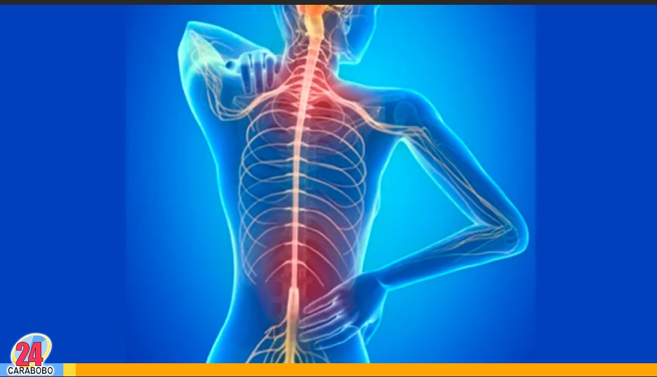 Esclerosis Múltiple