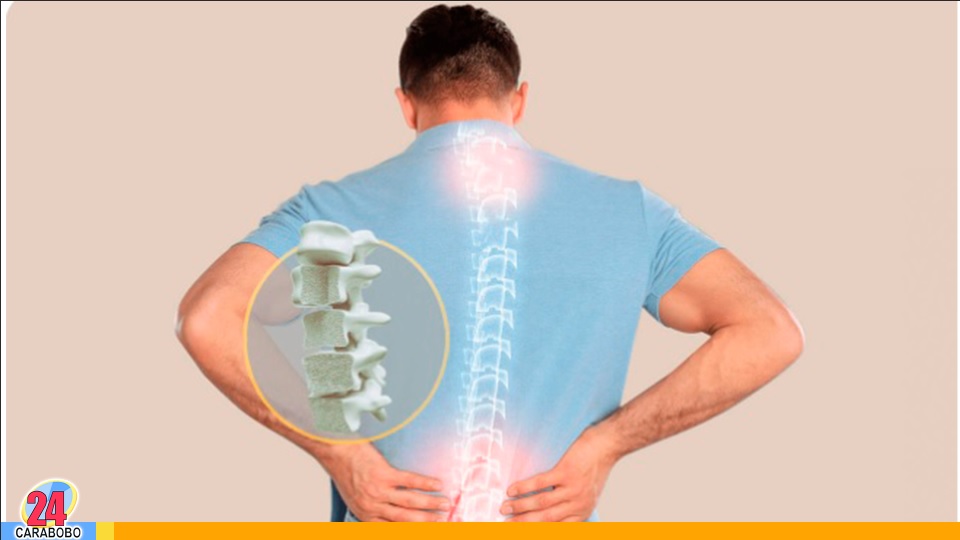 la osteoporosis
