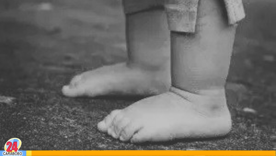 Niño murió ahogado en Portuguesa