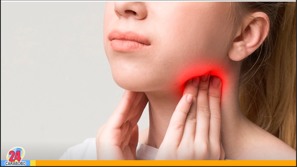 El cáncer linfoma no Hodgkin se origina en el sistema linfático, el cual es la red del cuerpo para combatir las infecciones. Es llamado también cáncer linfático,