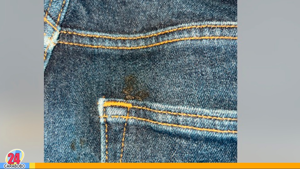 ¿Cómo quitar una mancha a un blue jean sin dañarlo?